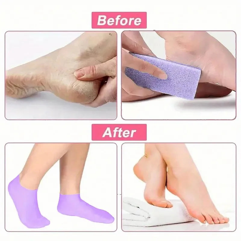 Silicone Moisturizing Socks for Dry Cracked Feet