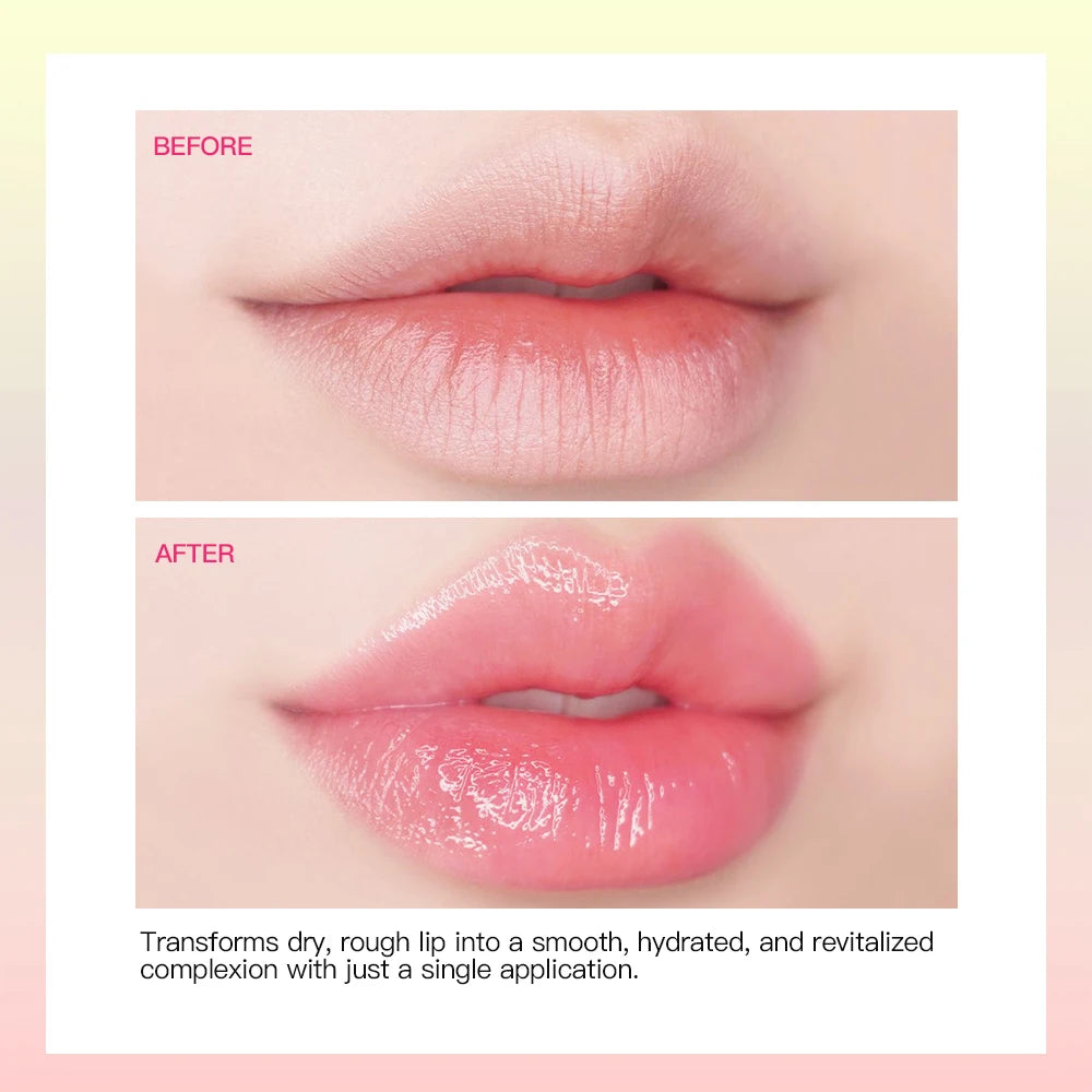 Moisturizing Lip Balm For Cracked Lips And Dry Skin - 4