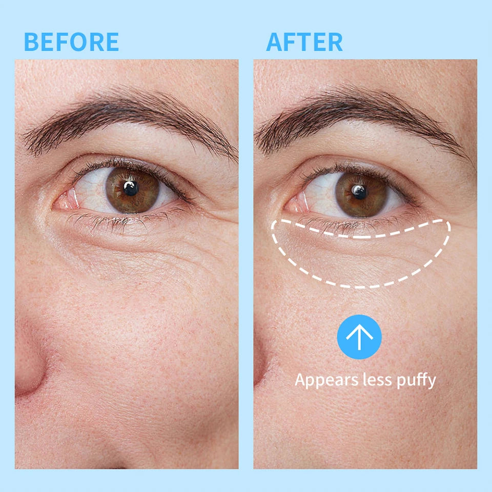 Hydrating Eye Gel Roller for Dark Circles and Puffiness - 11