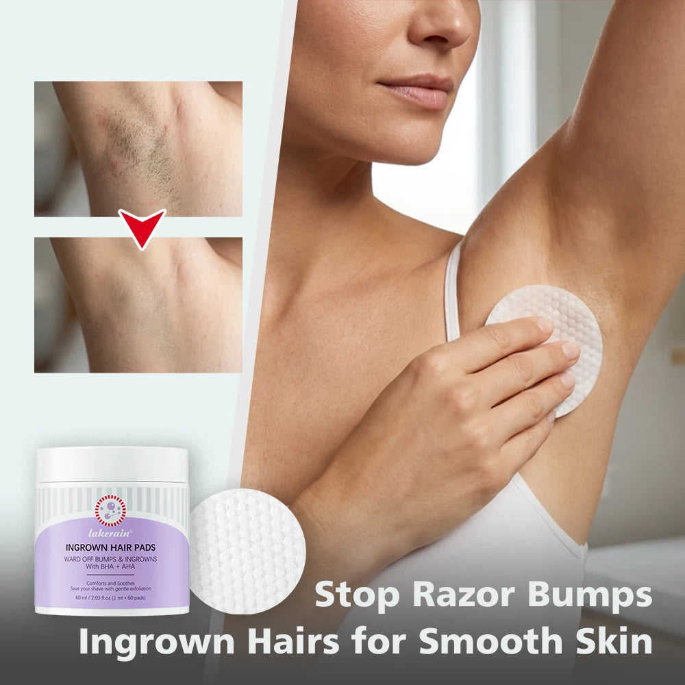 Ingrown Hair Treatment Cotton Pads for Razor Bumps and Exfoliation