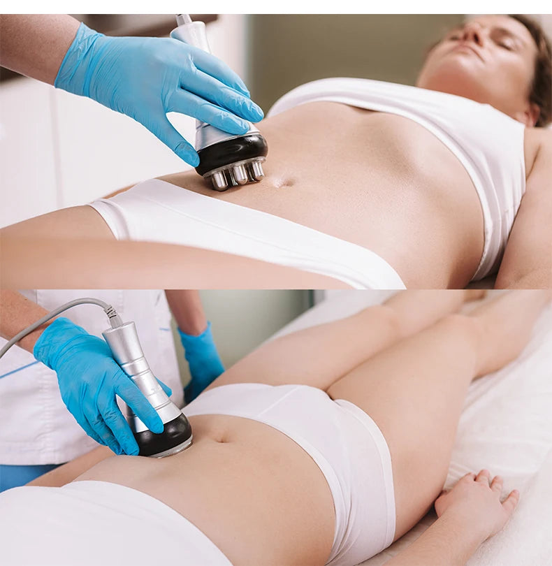 40K Ultrasonic Cavitation and Radio Frequency Body Slimming Machine