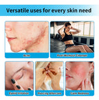 Hypochlorous Acid Facial Spray Skin Toner