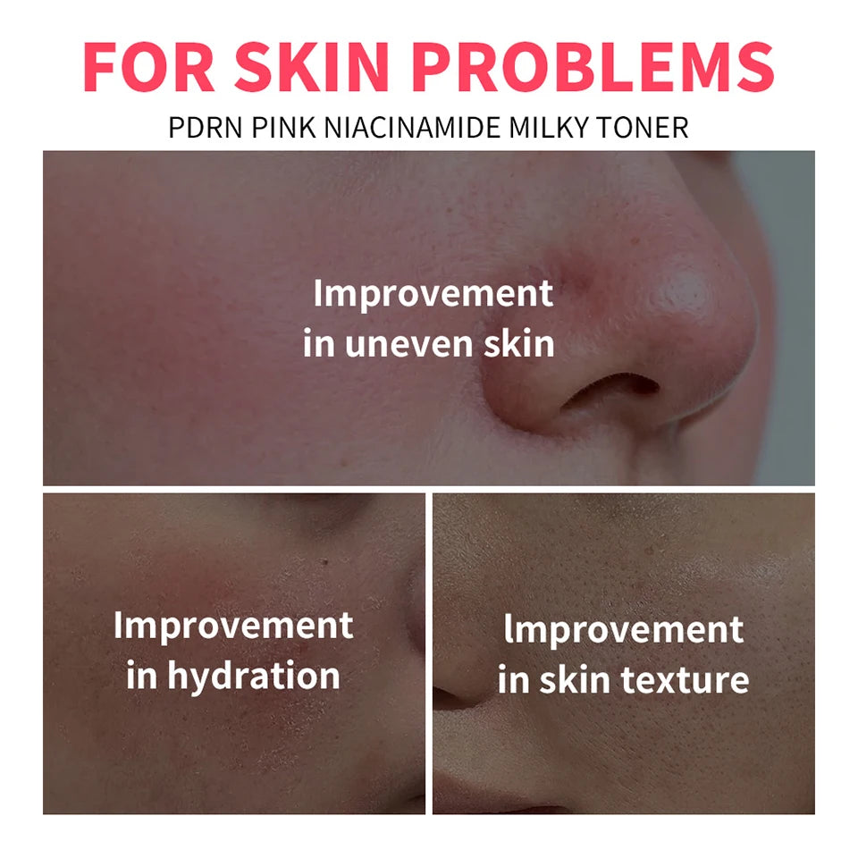 PDRN Niacinamide Milky Facial Toner Hydrating Skincare Lotion - 8