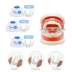 3 Stage Kids Silicone Dental Alignment Trainer Retainer Set