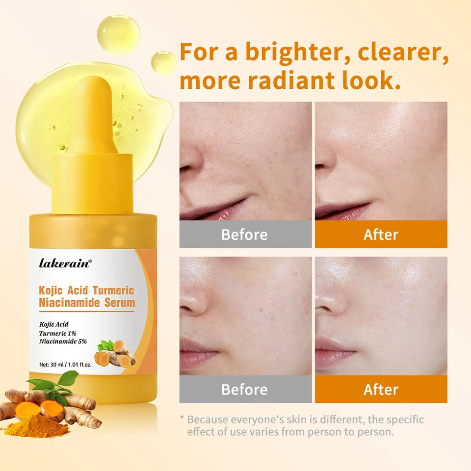 Kojic Acid Turmeric Niacinamide Face Serum Brightening Skin Essence - 11
