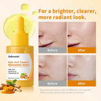 Kojic Acid Turmeric Niacinamide Face Serum Brightening Skin Essence