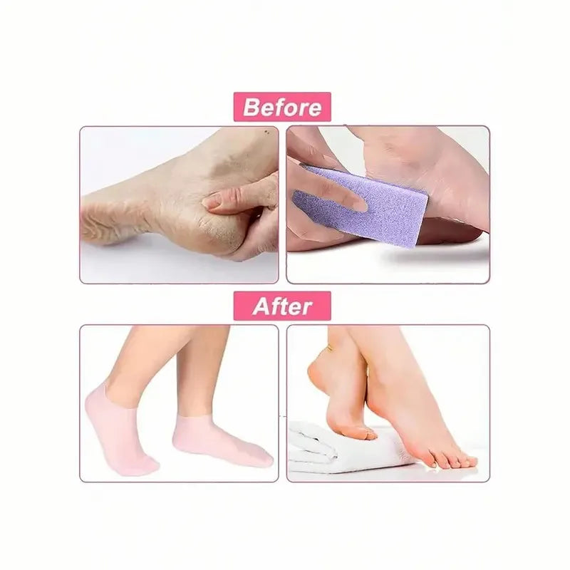 Silicone Moisturizing Socks for Dry Cracked Feet