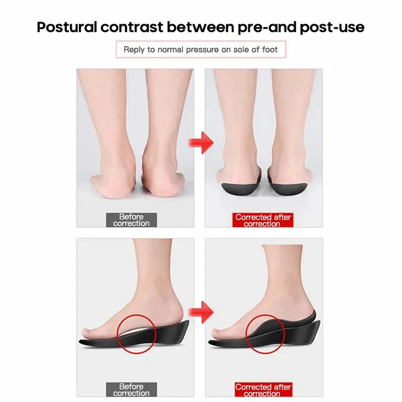 TPR Arch Support Orthopedic Shoe Insoles for Flat Feet