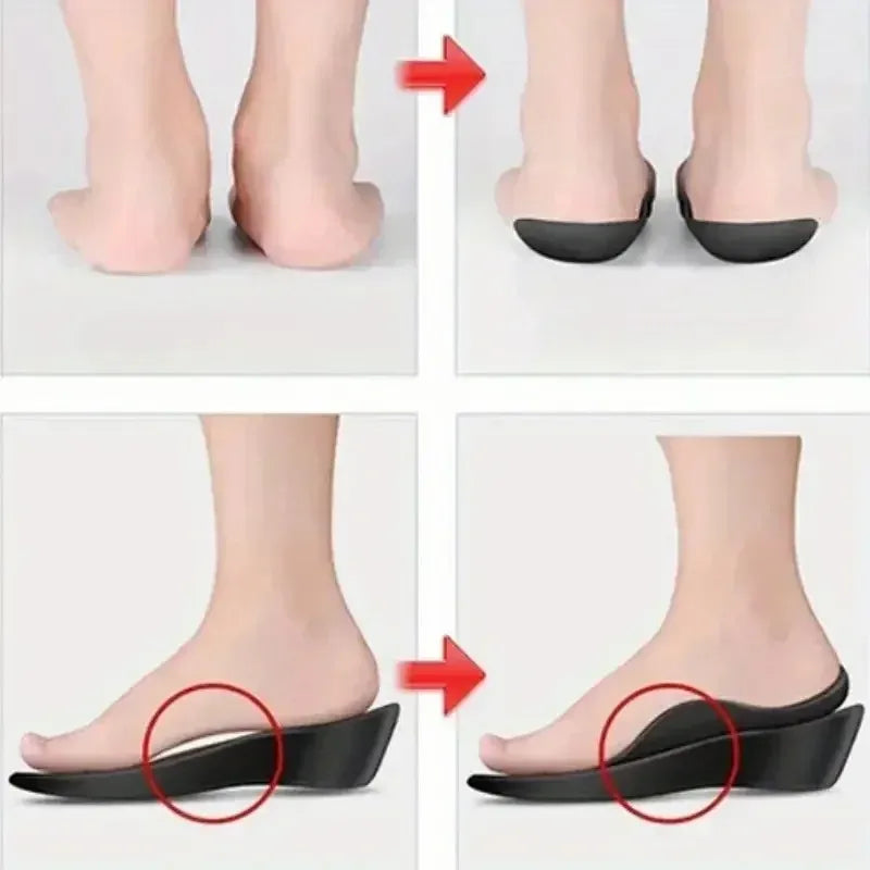 TPR Arch Support Orthopedic Shoe Insoles for Flat Feet - 12