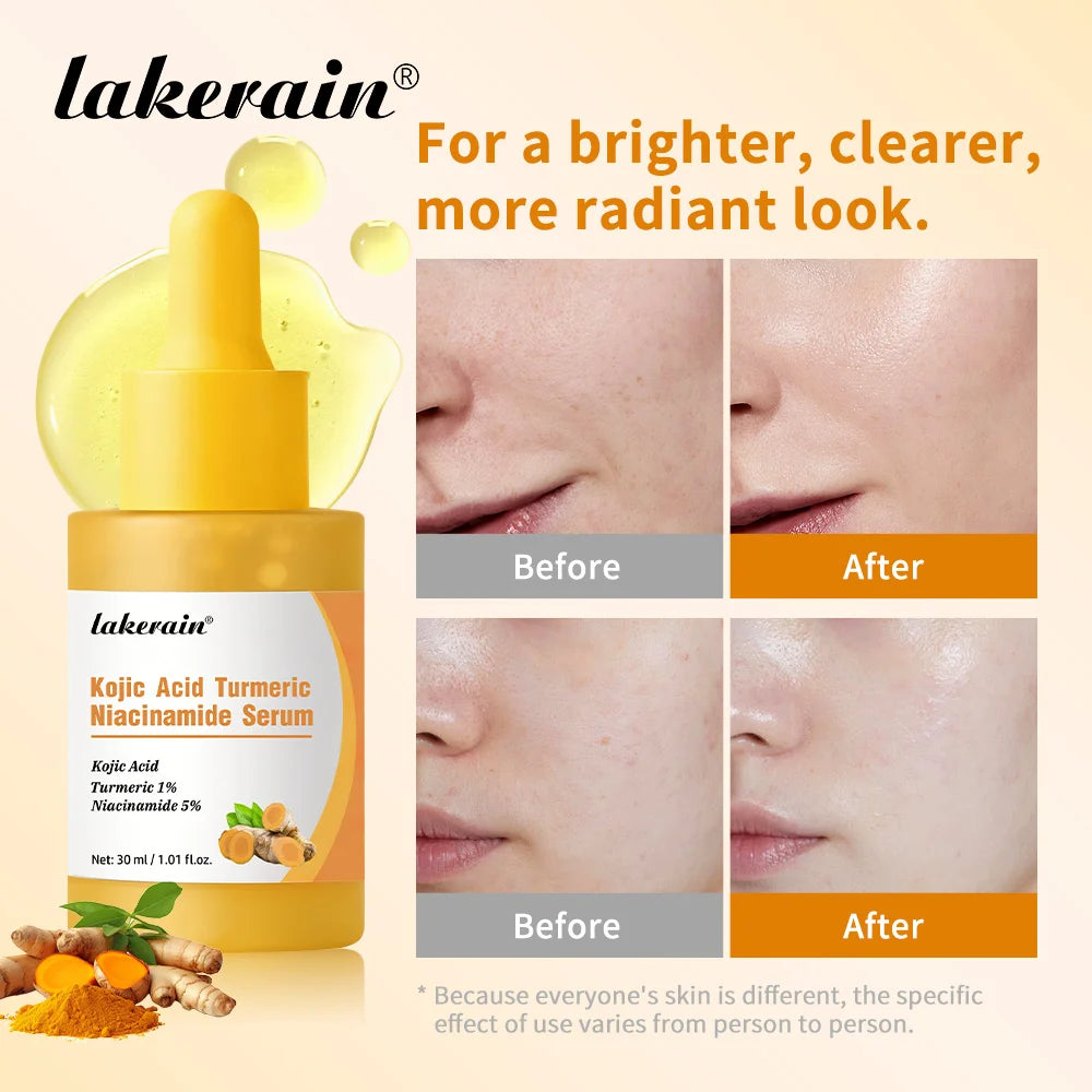Kojic Acid Turmeric Niacinamide Face Serum Brightening Skin Essence