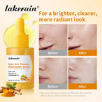 Kojic Acid Turmeric Niacinamide Face Serum Brightening Skin Essence