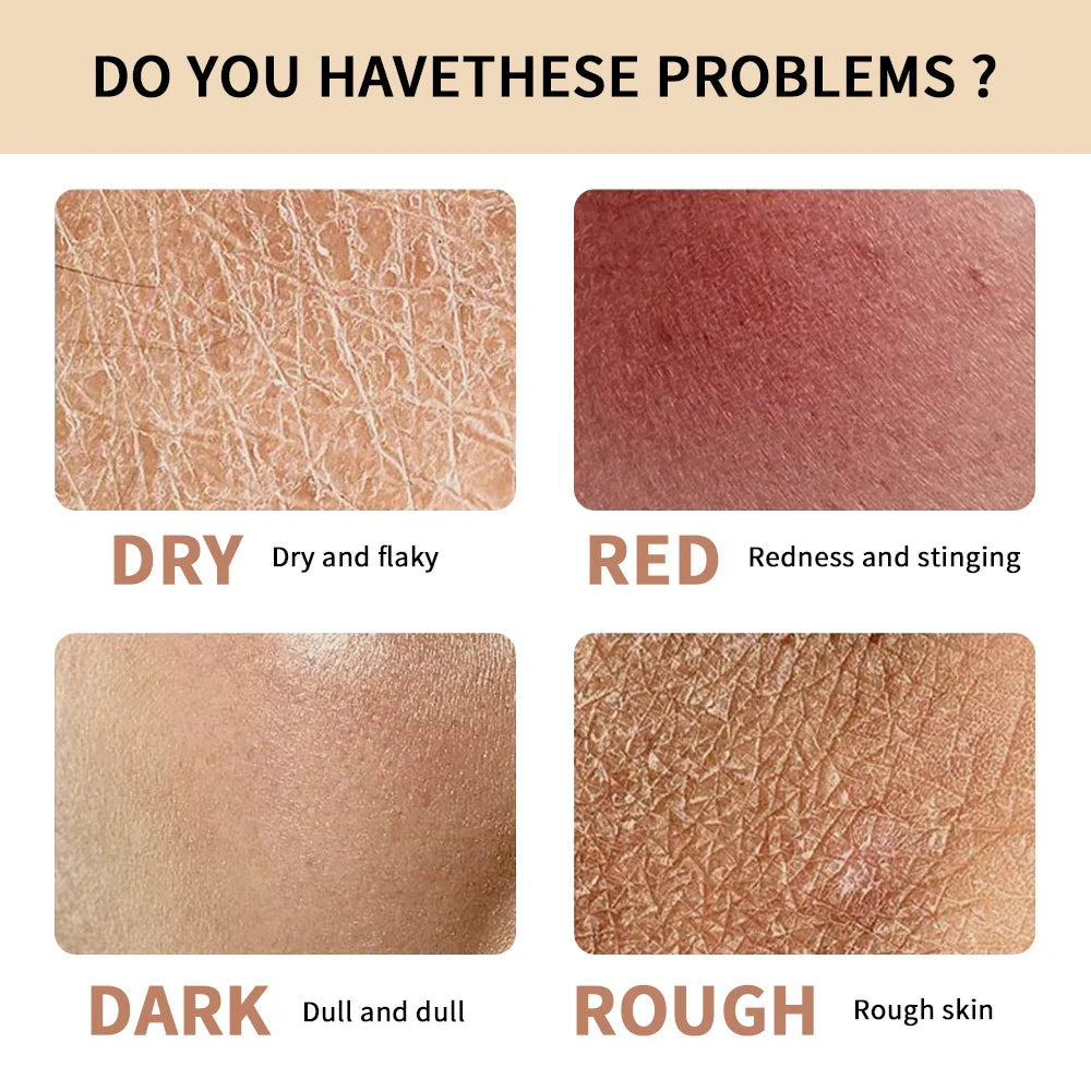 Hydrogel Facial Moisturizer Deep Hydration Skin Care Cream