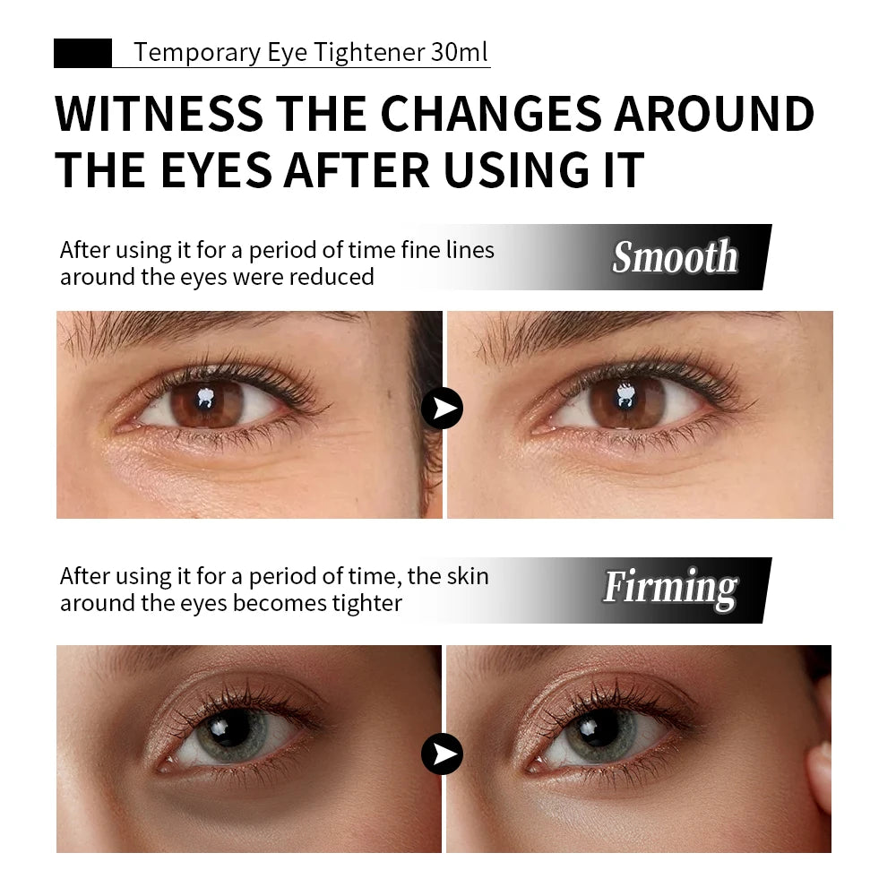 Temporary Eye Tightener Cream Firming Anti Aging Treatment - 5