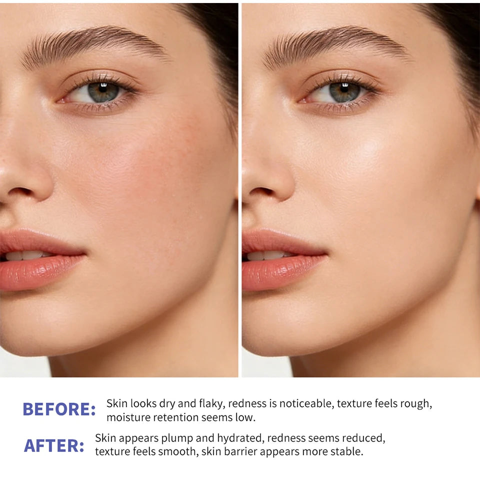 Triple Lipid Peptide Face Cream Moisturizing Skin Care Treatment