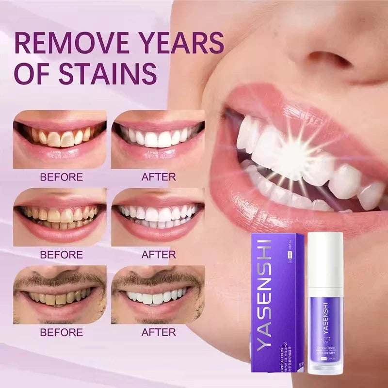 30ml Whitening Toothpaste Deep Cleaning Oral Care Essence - 2