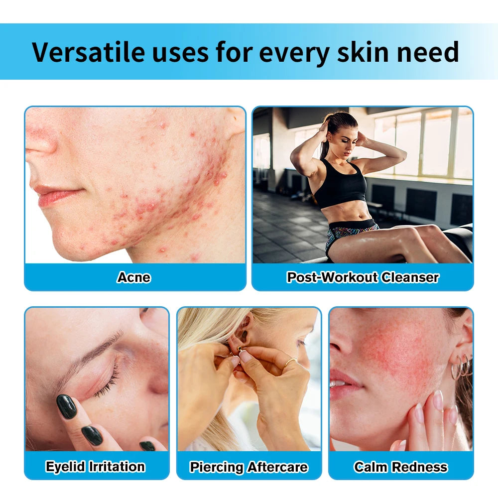 Hypochlorous Acid Facial Spray Skin Toner