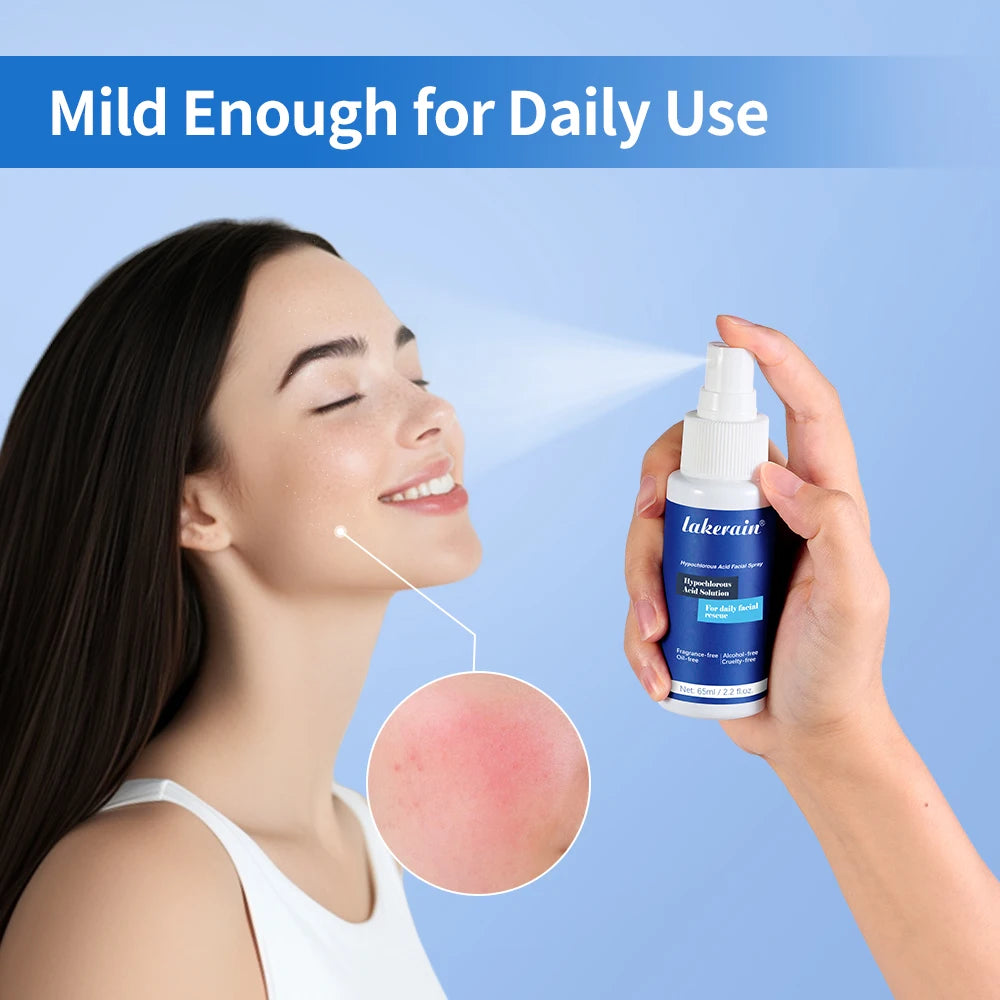 Hypochlorous Acid Facial Spray Skin Toner